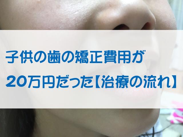 子供の歯の矯正費用が20万円だった 治療の流れ だんごの噂